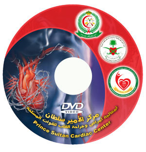 قرص مركز الأمير سلطان لمعالجة أمراض وجراحة القلب للقوات المسلحة